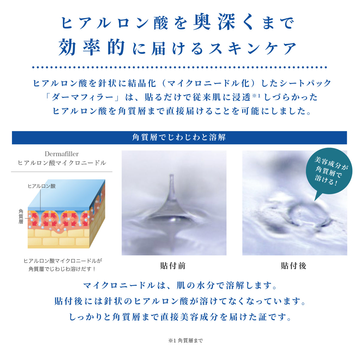 えい マイクロニードルチップ6個＋導入機1台 えい マイクロニードルチップ6個＋導入機1台 Amazon.co.jp: クリニラボ